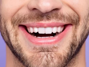 Beckenham Smiles Dental Checkup