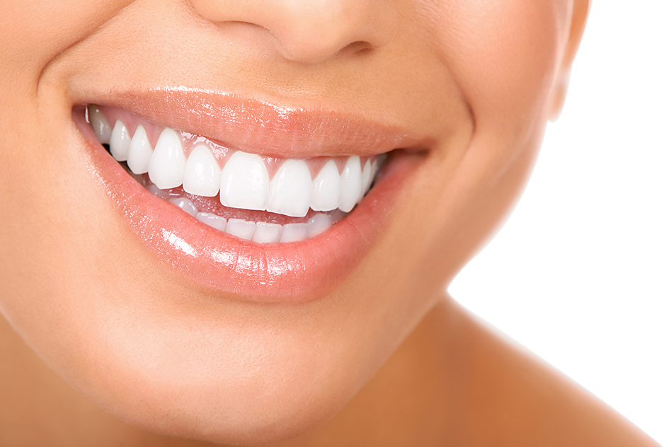 Beckenham Teeth whitening
