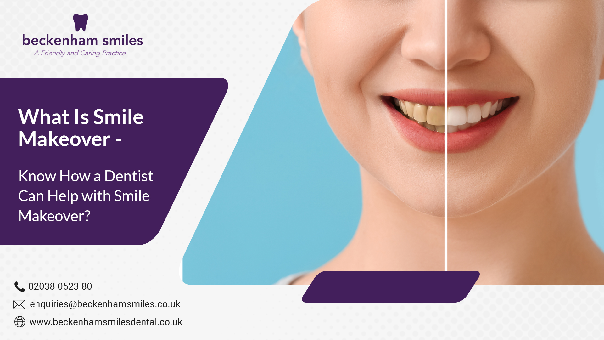 What Is Smile Makeover - Do you Know How a Dentist Can Help with a Smile Makeover?